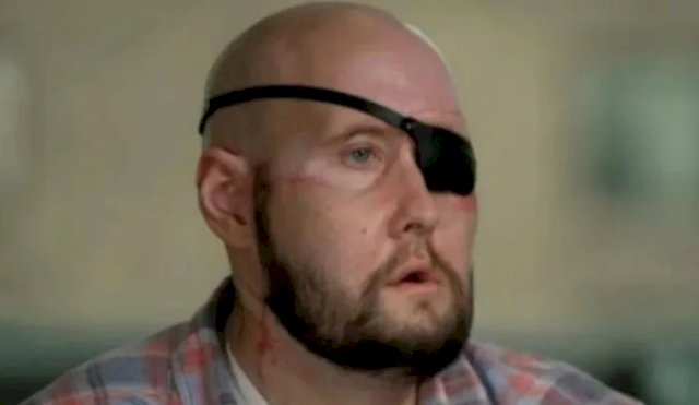 Trasplantan por primera vez un ojo humano por completo